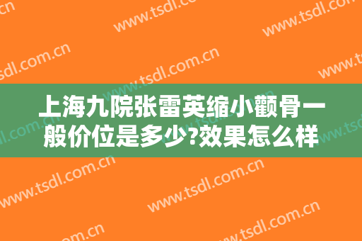 上海九院张雷英缩小颧骨一般价位是多少?效果怎么样?