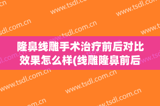 隆鼻线雕手术治疗前后对比效果怎么样(线雕隆鼻前后对比效果图)