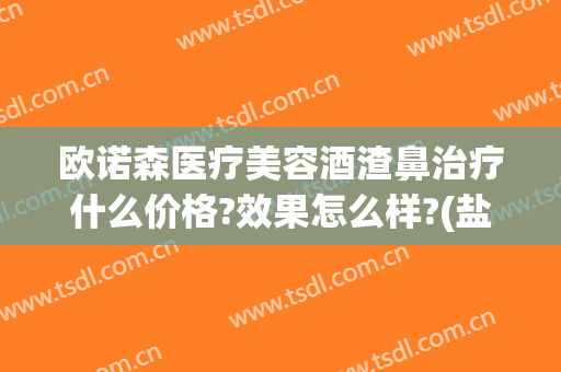 欧诺森医疗美容酒渣鼻治疗什么价格?效果怎么样?(盐酸米诺环素治疗酒渣鼻)