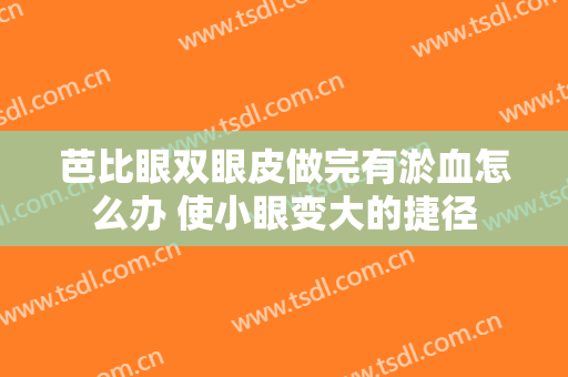 芭比眼双眼皮做完有淤血怎么办 使小眼变大的捷径