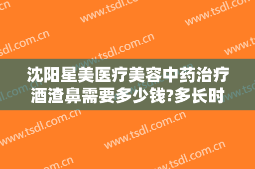沈阳星美医疗美容中药治疗酒渣鼻需要多少钱?多长时间恢复?