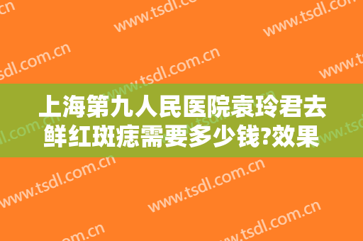 上海第九人民医院袁玲君去鲜红斑痣需要多少钱?效果怎么样?