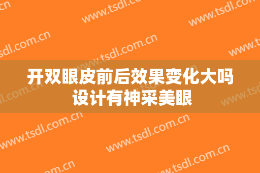 开双眼皮前后效果变化大吗 设计有神采美眼