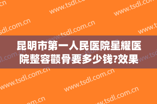 昆明市第一人民医院星耀医院整容颧骨要多少钱?效果怎么样?(昆明星耀医院双眼皮做的好吗?)