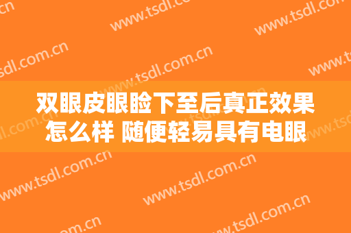 双眼皮眼睑下至后真正效果怎么样 随便轻易具有电眼