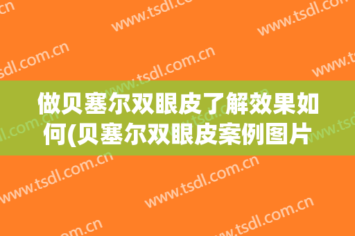 做贝塞尔双眼皮了解效果如何(贝塞尔双眼皮案例图片)