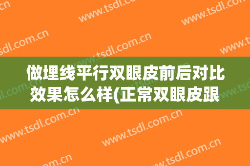 做埋线平行双眼皮前后对比效果怎么样(正常双眼皮跟埋线双眼皮对比)