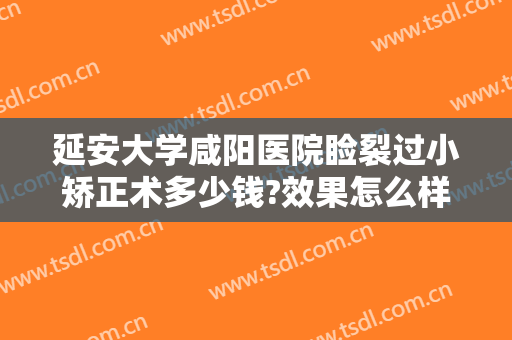 延安大学咸阳医院睑裂过小矫正术多少钱?效果怎么样?