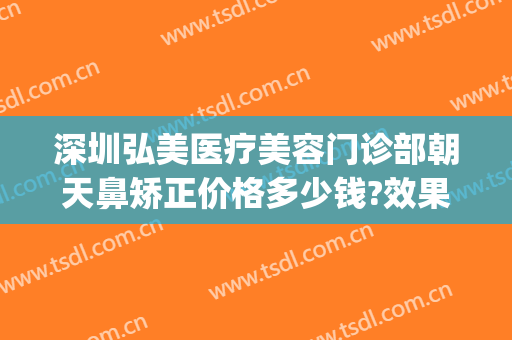 深圳弘美医疗美容门诊部朝天鼻矫正价格多少钱?效果怎么样?(深圳弘美整形口碑)