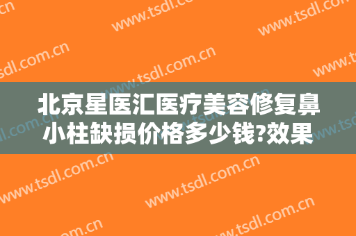 北京星医汇医疗美容修复鼻小柱缺损价格多少钱?效果怎么样?