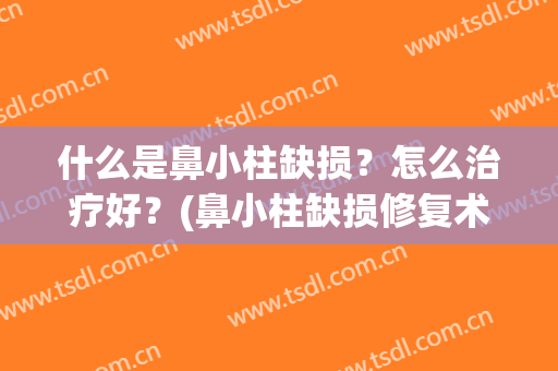 什么是鼻小柱缺损？怎么治疗好？(鼻小柱缺损修复术方法)
