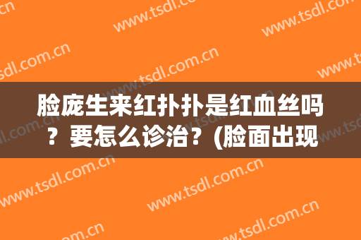 脸庞生来红扑扑是红血丝吗？要怎么诊治？(脸面出现红血丝是咋回事)