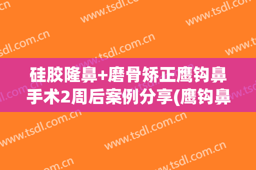 硅胶隆鼻+磨骨矫正鹰钩鼻手术2周后案例分享(鹰钩鼻做整形多少钱)