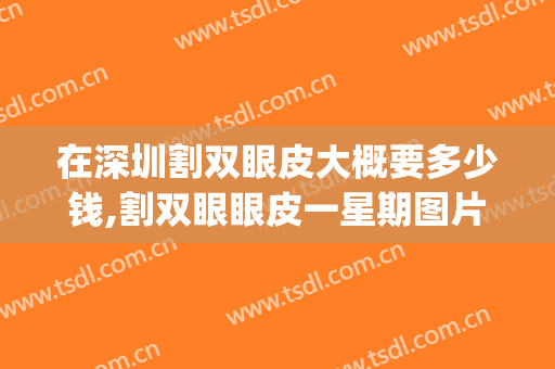 在深圳割双眼皮大概要多少钱,割双眼眼皮一星期图片6(深圳做双眼皮大概要需要多少钱)