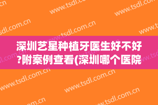 深圳艺星种植牙医生好不好?附案例查看(深圳哪个医院种植牙好)