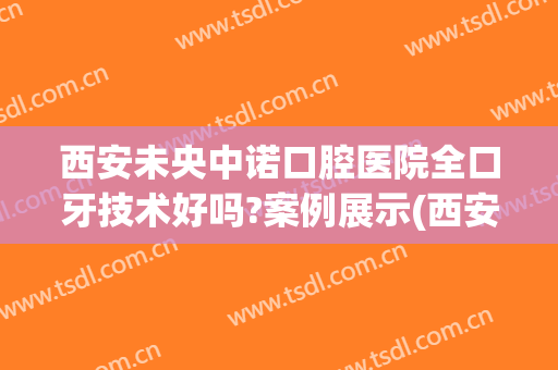 西安未央中诺口腔医院全口牙技术好吗?案例展示(西安中诺口腔医院评价)