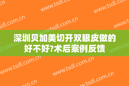 深圳贝加美切开双眼皮做的好不好?术后案例反馈