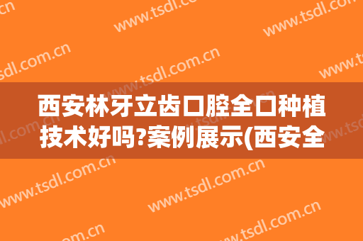 西安林牙立齿口腔全口种植技术好吗?案例展示(西安全口种植牙医院)