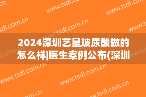 2024深圳艺星玻尿酸做的怎么样|医生案例公布(深圳艺星整形正规吗)