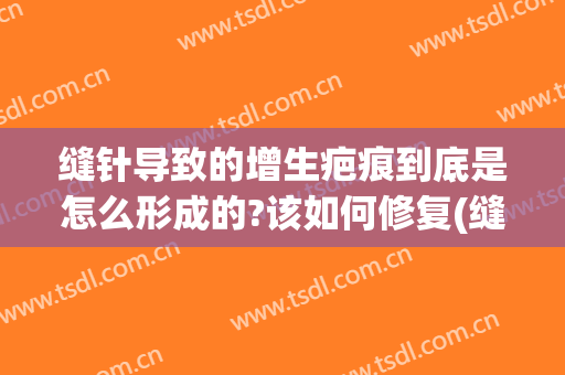 缝针导致的增生疤痕到底是怎么形成的?该如何修复(缝针后疤痕增生什么时候后消除)
