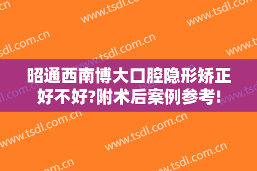 昭通西南博大口腔隐形矫正好不好?附术后案例参考!