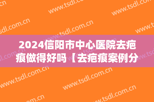 2024信阳市中心医院去疤痕做得好吗【去疤痕案例分享】(信阳祛疤医院)