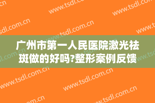 广州市第一人民医院激光祛斑做的好吗?整形案例反馈(广州做激光祛斑多少钱)