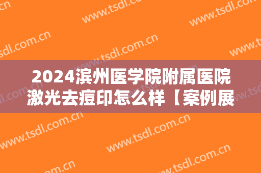 2024滨州医学院附属医院激光去痘印怎么样【案例展示】
