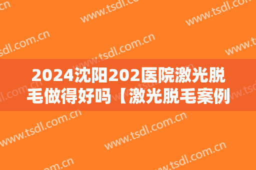2024沈阳202医院激光脱毛做得好吗【激光脱毛案例分享】