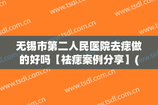 无锡市第二人民医院去痣做的好吗【祛痣案例分享】(无锡哪家医院可以去痣)