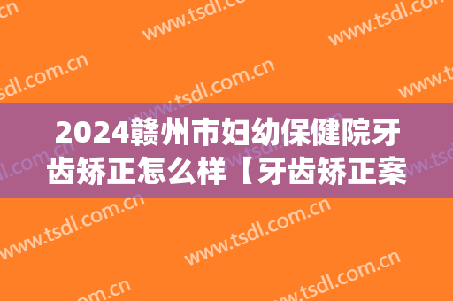 2024赣州市妇幼保健院牙齿矫正怎么样【牙齿矫正案例】(赣州附属医院牙科矫正牙齿)