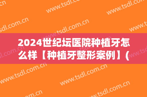 2024世纪坛医院种植牙怎么样【种植牙整形案例】(种植牙20年成功率)