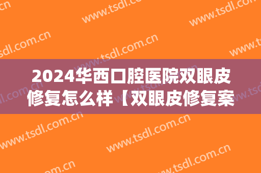 2024华西口腔医院双眼皮修复怎么样【双眼皮修复案例】(华西双眼皮修复专家)
