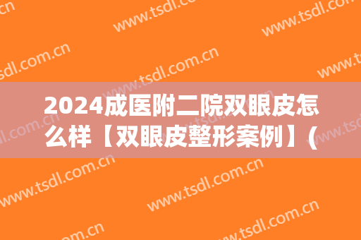 2024成医附二院双眼皮怎么样【双眼皮整形案例】(成都二医院双眼皮)