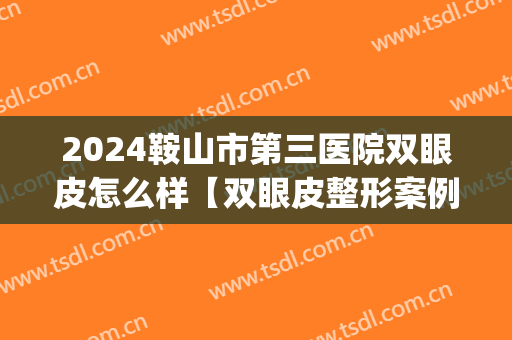 2024鞍山市第三医院双眼皮怎么样【双眼皮整形案例】(鞍山谁家做双眼皮好看)