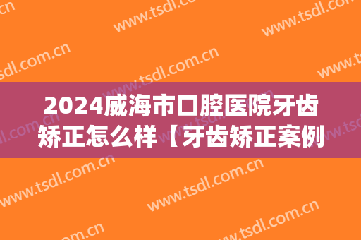 2024威海市口腔医院牙齿矫正怎么样【牙齿矫正案例】(威海牙齿矫正多少钱)