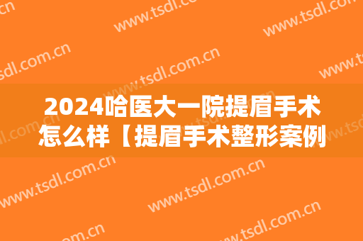 2024哈医大一院提眉手术怎么样【提眉手术整形案例】