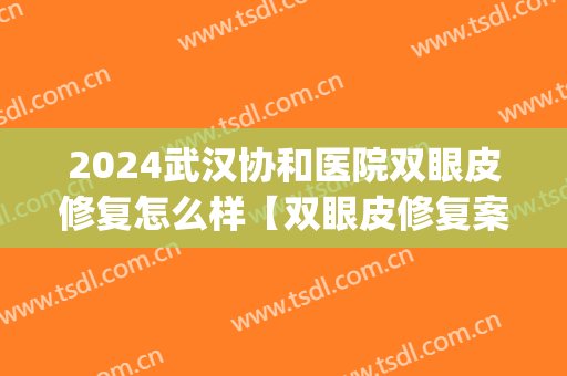 2024武汉协和医院双眼皮修复怎么样【双眼皮修复案例】(武汉协和医院割双眼皮哪个医生好)