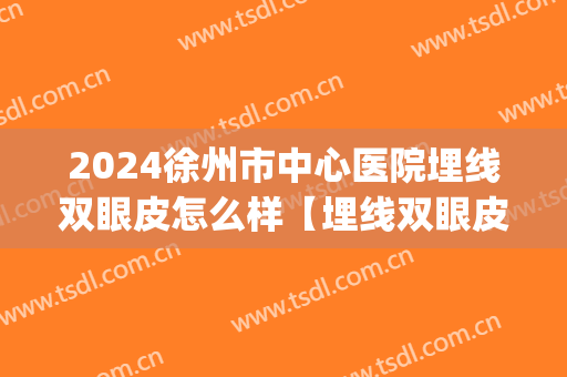2024徐州市中心医院埋线双眼皮怎么样【埋线双眼皮案例】(徐州双眼皮拆线)