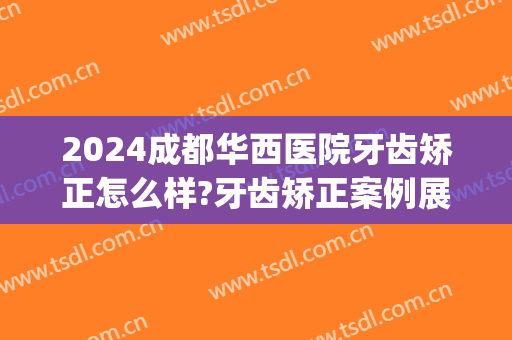 2024成都华西医院牙齿矫正怎么样?牙齿矫正案例展示(成都华西牙齿正畸)