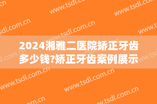 2024湘雅二医院矫正牙齿多少钱?矫正牙齿案例展示(湖南湘雅医院牙齿矫正费用)