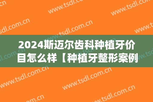 2024斯迈尔齿科种植牙价目怎么样【种植牙整形案例】(2024种植牙品牌)