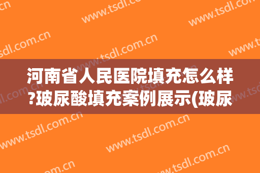 河南省人民医院填充怎么样?玻尿酸填充案例展示(玻尿酸填充操作视频)
