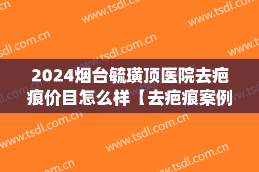 2024烟台毓璜顶医院去疤痕价目怎么样【去疤痕案例】(烟台毓璜顶医院贵吗)