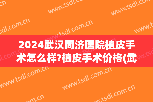2024武汉同济医院植皮手术怎么样?植皮手术价格(武汉同济医院能植发吗) 2024武汉同济医院植皮手术怎么样?植皮手术价格(武汉同济医院能植发吗)