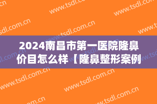 2024南昌市第一医院隆鼻价目怎么样【隆鼻整形案例】(南昌哪个医生隆鼻做得好)
