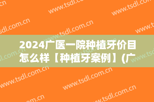 2024广医一院种植牙价目怎么样【种植牙案例】(广州种植牙多少钱一颗2024价格表)