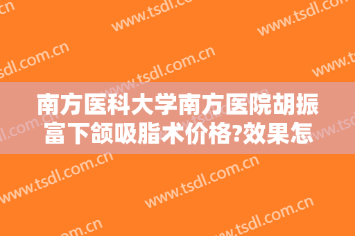 南方医科大学南方医院胡振富下颌吸脂术价格?效果怎么样?