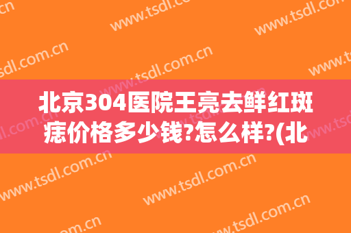 北京304医院王亮去鲜红斑痣价格多少钱?怎么样?(北京304医院光动力治疗鲜红斑痣)