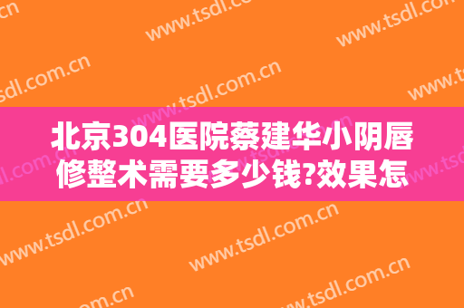 北京304医院蔡建华小阴唇修整术需要多少钱?效果怎么样?